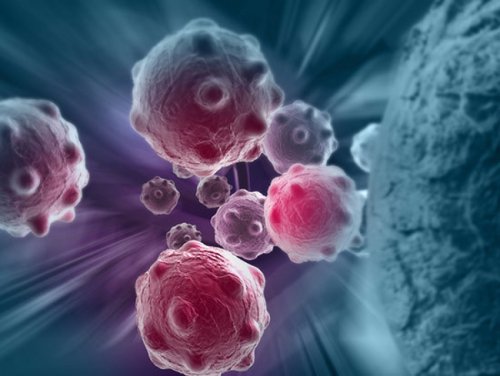 Multiple myeloma (MM)
