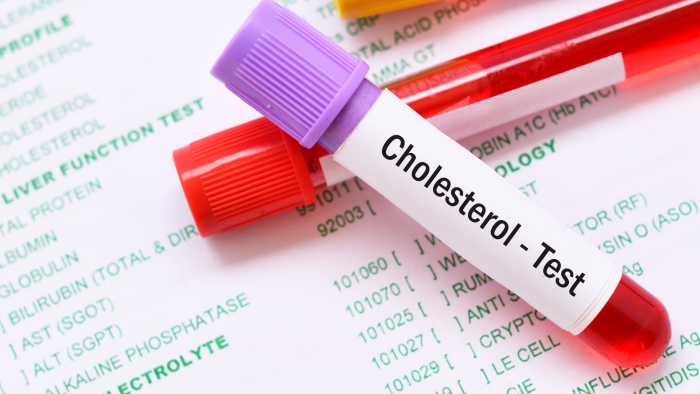 Cholesterol