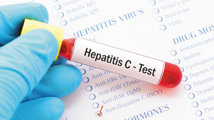 hepatitis